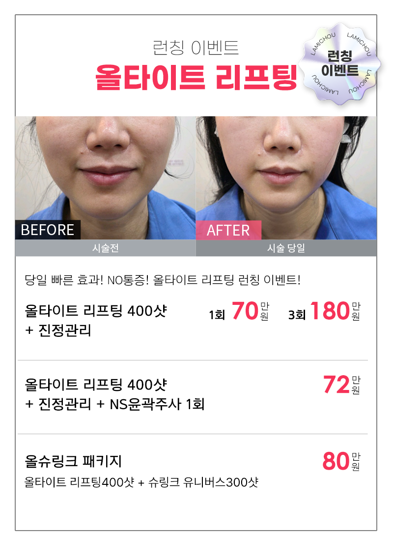 2512 카톡 이벤트02.png